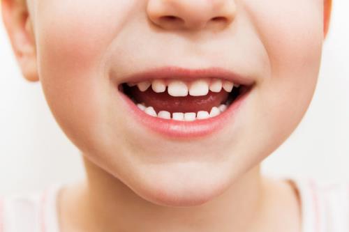 قطره آهن دندان کودک را سیاه می کند فریب تبلیغات را نخورید